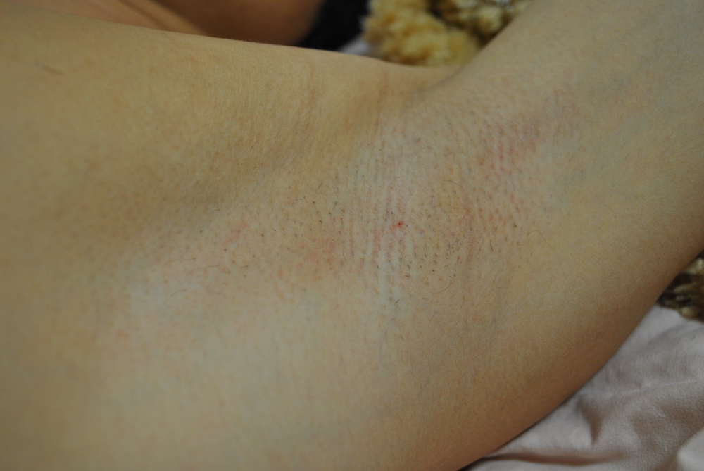 fundoshigentleman-after-shaved-armpit-left